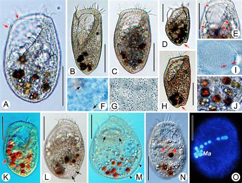  Vorticella! Tiny Whirlpools of Life – An Exploration into Their Mesmerizing World